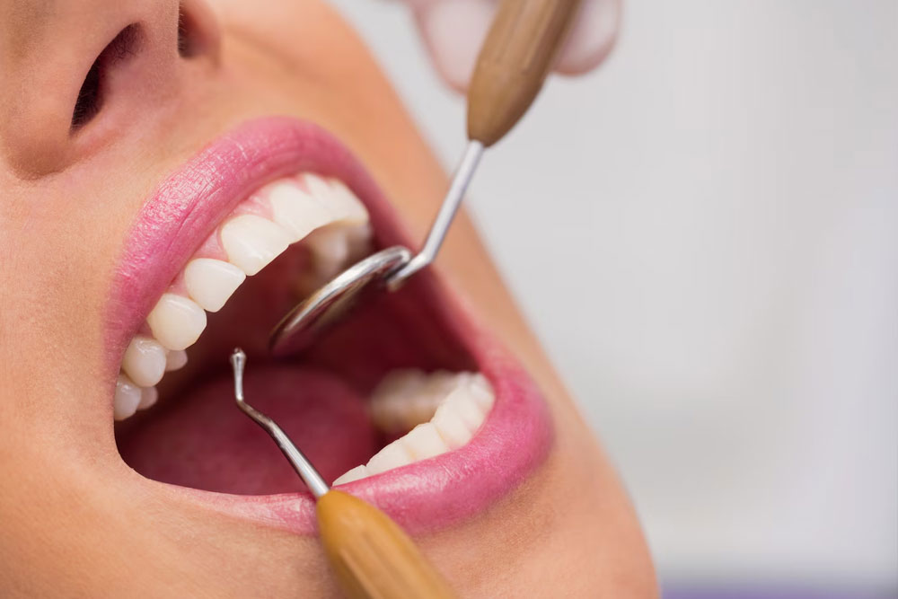 Dentist examining female patient teeth.jpg  West Hollywood, CA 